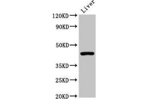 Western Blot Positive WB detected in: Mouse liver tissue All lanes: CLEC4M antibody at 2 μg/mL Secondary Goat polyclonal to rabbit IgG at 1/50000 dilution Predicted band size: 46, 31, 37, 27, 38, 29, 43, 34, 25 kDa Observed band size: 46 kDa