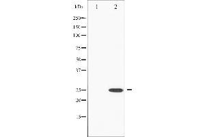 Western blot analysis of RhoA phosphorylation expression in HeLa whole cell lysates,The lane on the left is treated with the antigen-specific peptide. (RHOA anticorps  (pSer188))