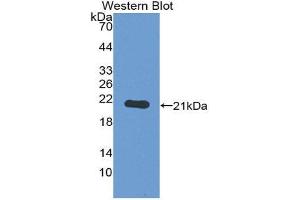 Western Blotting (WB) image for anti-Toll-Like Receptor 7 (TLR7) (AA 890-1037) antibody (ABIN1863225) (TLR7 anticorps  (AA 890-1037))
