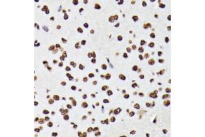 Immunohistochemistry of paraffin-embedded rat brain using Phospho-STA-Y694 antibody (ABIN6135328, ABIN6136272, ABIN6136273 and ABIN7101887) at dilution of 1:100 (40x lens). (STAT5A anticorps  (pTyr694))