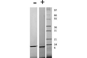 SDS-PAGE of Human Monocyte Chemotactic Protein-4 (CCL13) Recombinant Protein SDS-PAGE of Human Monocyte Chemotactic Protein-4 (CCL13) Recombinant Protein.