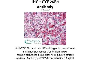 Image no. 1 for anti-Cytochrome P450, Family 26, Subfamily B, Polypeptide 1 (CYP26B1) (AA 160-396) antibody (ABIN1733454) (CYP26B1 anticorps  (AA 160-396))