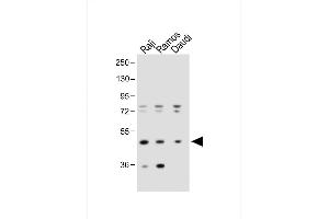 All lanes : Anti-IGHE Antibody (Center) at 1:1000 dilution Lane 1: Raji whole cell lysate Lane 2: Ramos whole cell lysate Lane 3:Daudi whole cell lysate Lysates/proteins at 20 μg per lane. (IgE anticorps  (AA 246-275))