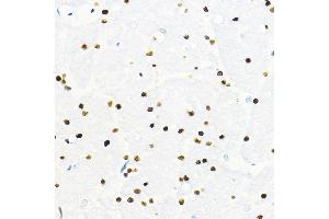Immunohistochemistry of paraffin-embedded mouse brain using ZEB2 Rabbit pAb (ABIN6131480, ABIN6150424, ABIN6150425 and ABIN6221369) at dilution of 1:100 (40x lens).