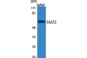 Western Blot (WB) analysis of specific cells using EAAT3 Polyclonal Antibody. (SLC1A1 anticorps  (Internal Region))