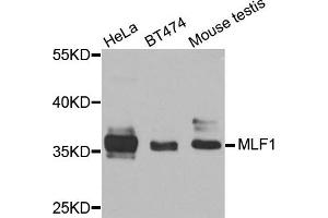 Western blot analysis of extracts of various cells, using MLF1 antibody. (MLF1 anticorps)