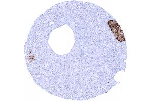 Islet cells of the pancreas show intense chromogranin A staining