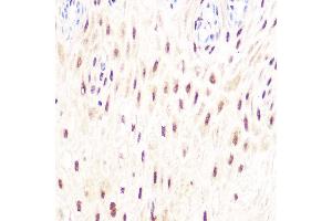 Immunohistochemistry of paraffin-embedded human esophageal using DP1/TFDP1 Rabbit mAb (ABIN7270891) at dilution of 1:100 (40x lens). (DP1 anticorps)