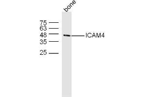 Mouse bone lysates probed with ICAM4 Polyclonal Antibody, unconjugated  at 1:300 overnight at 4°C followed by a conjugated secondary antibody at 1:10000 for 60 minutes at 37°C. (ICAM4 anticorps  (AA 85-180))