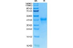Mouse DR3 on Tris-Bis PAGE under reduced condition. (DR3/LARD Protein (AA 31-196) (His tag))