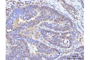 IHC analysis of RANBP2 using anti-RANBP2 antibody (ABIN7602650). (RANBP2 anticorps  (AA 906-2744))