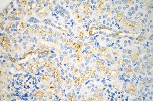 anti-Protein Kinase C, alpha (PKCa) antibody