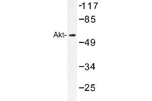 Image no. 1 for anti-V-Akt Murine Thymoma Viral Oncogene Homolog 1 (AKT1) antibody (ABIN272119) (AKT1 anticorps)