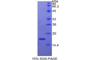 SDS-PAGE analysis of Cow ADM Protein. (Adrenomedullin Protein (ADM))