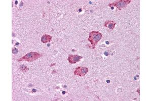 Anti-HGF antibody IHC of human brain, cortex.