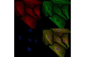 ABIN6257958 and ABIN6274924 staining  cells by IF/ICC. (BAIAP2L1 anticorps  (Internal Region))