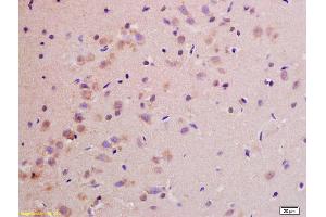 Formalin-fixed and paraffin embedded rat brain labeled with Rabbit Anti NDUFS1(75kD) Polyclonal Antibody, Unconjugated (ABIN750703) at 1:200 followed by conjugation to the secondary antibody and DAB staining (NDUFS1 anticorps  (AA 51-150))