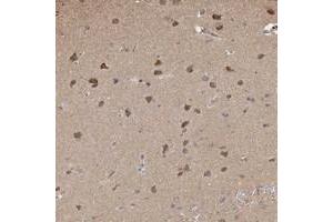 Immunohistochemical staining of human cerebral cortex with PLCH1 polyclonal antibody  shows moderate cytoplasmic positivity in neuronal cells. (PLCH1 anticorps)