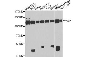 Western blot analysis of extracts of various cell lines, using VCP antibody. (VCP anticorps  (AA 647-806))
