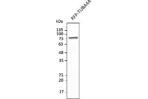 Western Blotting (WB) image for anti-tdTomato Fluorescent Protein (tdTomato) antibody (DyLight 550) (ABIN7273113) (tdTomato anticorps  (DyLight 550))