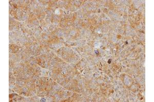 IHC-P Image Immunohistochemical analysis of paraffin-embedded SW480 xenograft, using CHI3L2, antibody at 1:500 dilution. (CHI3L2 anticorps)