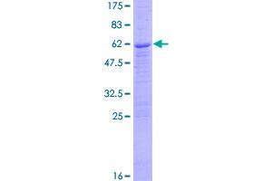 Image no. 1 for Palmitoyl-Protein Thioesterase 1 (PPT1) (AA 1-306) protein (GST tag) (ABIN1316094)