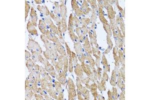 Immunohistochemistry of paraffin-embedded mouse heart using ATP5B antibody.