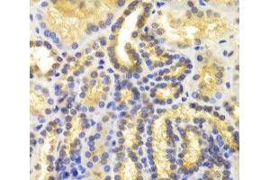 Immunohistochemistry of paraffin-embedded Human kidney using EIF5A Polyclonal Antibody at dilution of 1:100 (40x lens). (EIF5A anticorps)
