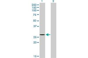 Western Blot analysis of NDUFS3 expression in transfected 293T cell line by NDUFS3 monoclonal antibody (M02), clone 1D6.