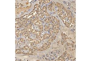 IHC analysis of SNRPD2 using anti-SNRPD2 antibody (ABIN7598963). (SNRPD2 anticorps  (AA 1-118))