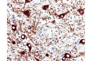 Dynamin (clone 41) staining on rat brain. (Dynamin 1 anticorps  (AA 698-851))