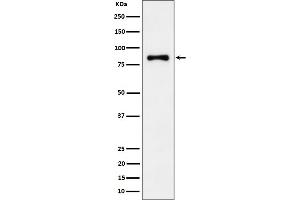 Western blot analysis of ALDH16A1 expression in Jurkat cell lysate.
