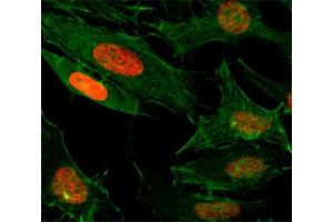 ICC/IF test of HeLa cells treated with sodium butyrate using recombinant H3K4ac antibody (red). (Recombinant Histone 3 anticorps  (acLys4))