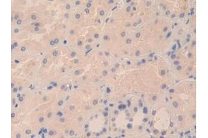 DAB staining on IHC-P; Samples: Human Kidney Tissue (TPSD1 anticorps  (AA 99-191))