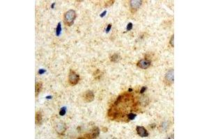 Immunohistochemical analysis of Clipin A staining in human brain formalin fixed paraffin embedded tissue section. (Coronin 1a anticorps)