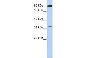 GRM6 antibody used at 0.