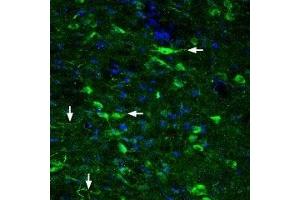 Expression of Glucagon-like peptide 2 receptor in rat hypothalamus - Immunohistochemical staining of rat hypothalamus with Anti-GLP2R (extracellular) Antibody (ABIN7043221, ABIN7044408 and ABIN7044409), (1:200).