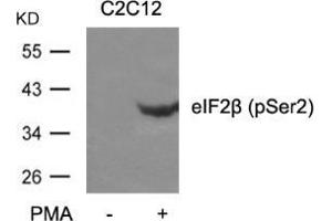Western blot analysis of extracts from C2C12 cells untreated or treated with PMA using eIF2β (phospho-Ser2). (EIF2S2 anticorps  (pSer2))