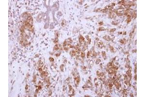 Image no. 1 for anti-Chondroadherin (CHAD) (AA 76-307) antibody (ABIN1497487) (CHAD anticorps  (AA 76-307))