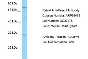 Western Blotting (WB) image for anti-Proteasome (Prosome, Macropain) 26S Subunit, ATPase, 1 (PSMC1) (N-Term) antibody (ABIN2786723)