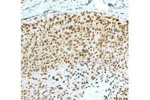 IHC analysis of KLF4 using anti-KLF4 antibody (ABIN7599343). (KLF4 anticorps  (AA 1-389))