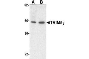 Western blot analysis of TRIM5 gamma expression in human bladder (A) and colon (B) cell lysate with TRIM5 gamma antibody at 2 μg /ml. (TRIM5 anticorps  (C-Term, Isoform gamma))
