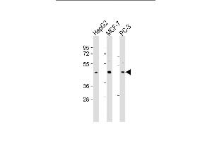All lanes : Anti-SCD2 Antibody (C-Term) at 1:2000 dilution Lane 1: HepG2 whole cell lysate Lane 2: MCF-7 whole cell lysate Lane 3: PC-3 whole cell lysate Lysates/proteins at 20 μg per lane. (SAPCD2 anticorps  (AA 333-367))