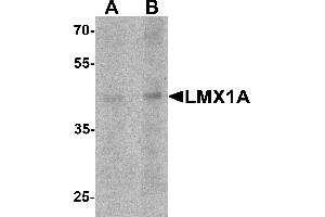 Western Blotting (WB) image for anti-LIM Homeobox Transcription Factor 1, alpha (LMX1A) (C-Term) antibody (ABIN1077395) (LMX1A anticorps  (C-Term))