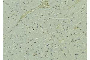 ABIN6273693 at 1/100 staining Mouse muscle tissue by IHC-P.