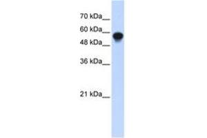 Image no. 1 for anti-Interferon Regulatory Factor 6 (IRF6) (C-Term) antibody (ABIN6742797) (IRF6 anticorps  (C-Term))