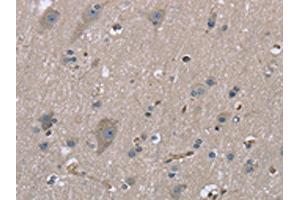 The image on the left is immunohistochemistry of paraffin-embedded Human brain tissue using ABIN7130317(MYL12B Antibody) at dilution 1/20, on the right is treated with fusion protein. (MYL12B anticorps)