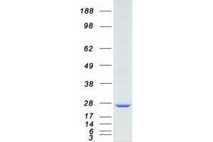 Validation with Western Blot