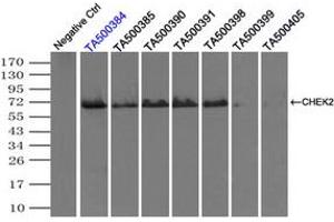 Image no. 3 for anti-Checkpoint Kinase 2 (CHEK2) antibody (ABIN1497497)