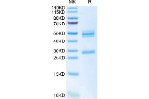 Mouse IL-12 on Tris-Bis PAGE under reduced condition.
